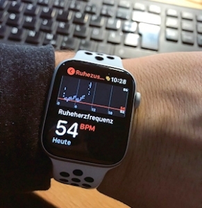 ekg with apple watch 4