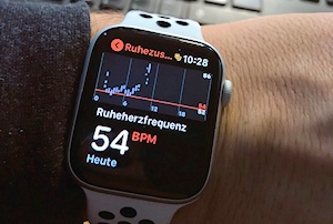 apple watch ekg
